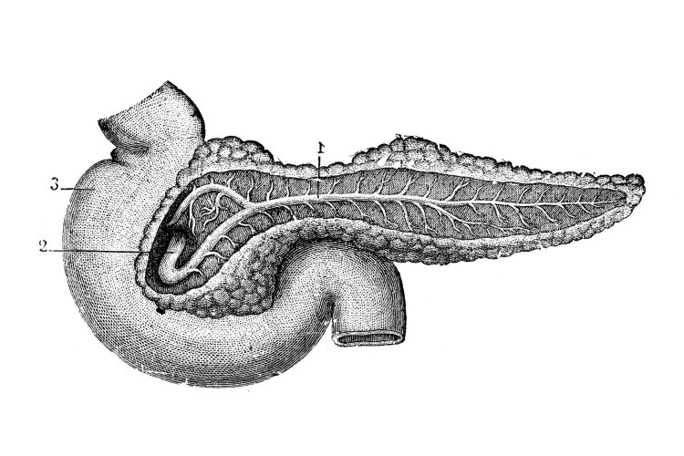 Πρώιμη διάγνωση για τον καρκίνο του παγκρέατος