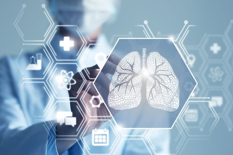 Θεραπεία για τον καρκίνο του πνεύμονα