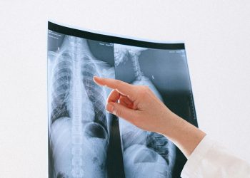 Πνευμονική υπέρταση