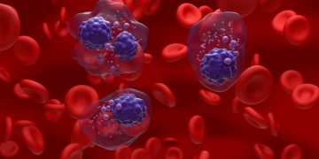 Φάρμακο για το πολλαπλό μυέλωμα