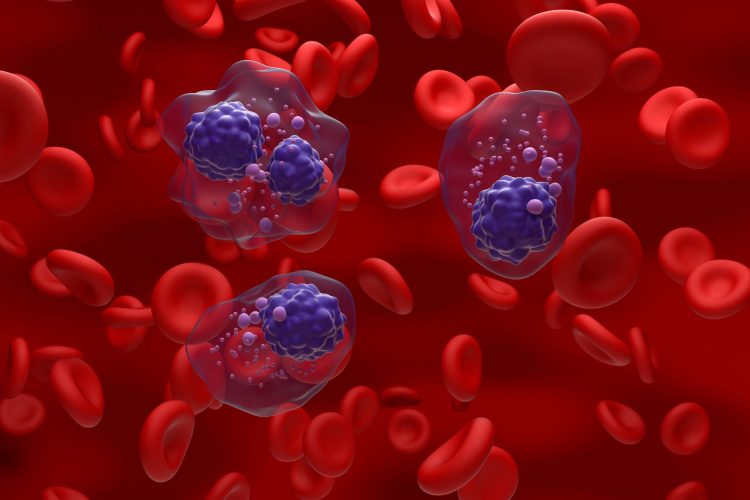 Φάρμακο για το πολλαπλό μυέλωμα