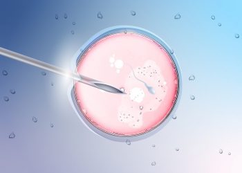 εξωσωματική γονιμοποίηση