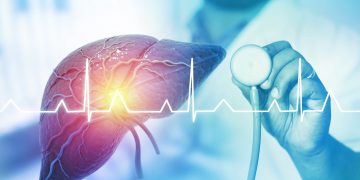 Νέα μελέτη αποκαλύπτει πως η λιπώδης νόσος του ήπατος, οδηγεί σε καρκίνο