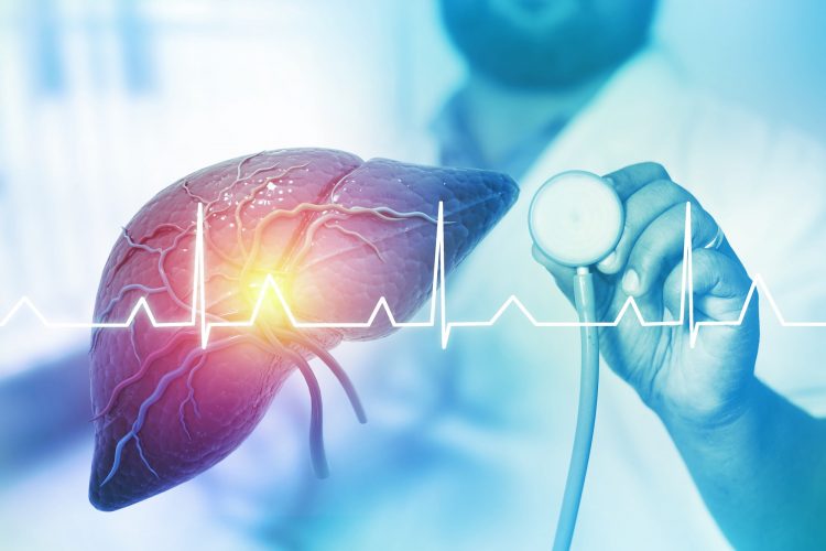 Νέα μελέτη αποκαλύπτει πως η λιπώδης νόσος του ήπατος, οδηγεί σε καρκίνο