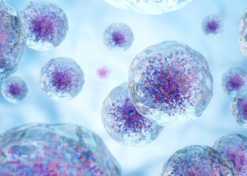 Η παχυσαρκία ισχυρότατος παράγοντας καρκίνου του ενδομητρίου