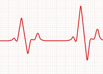 Σε κρίσιμη κατάσταση ο Μίμης Δομάζος: Η ανακοίνωση του Νοσοκομείου