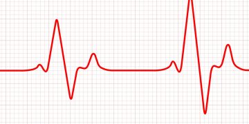 Σε κρίσιμη κατάσταση ο Μίμης Δομάζος: Η ανακοίνωση του Νοσοκομείου