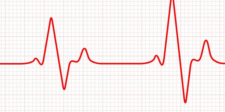 Σε κρίσιμη κατάσταση ο Μίμης Δομάζος: Η ανακοίνωση του Νοσοκομείου