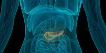 Καρκίνος του παγκρέατος