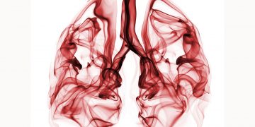 Καρκίνος των πνευμόνων: Προσυμπτωματικός έλεγχος και διακοπή καπνίσματος