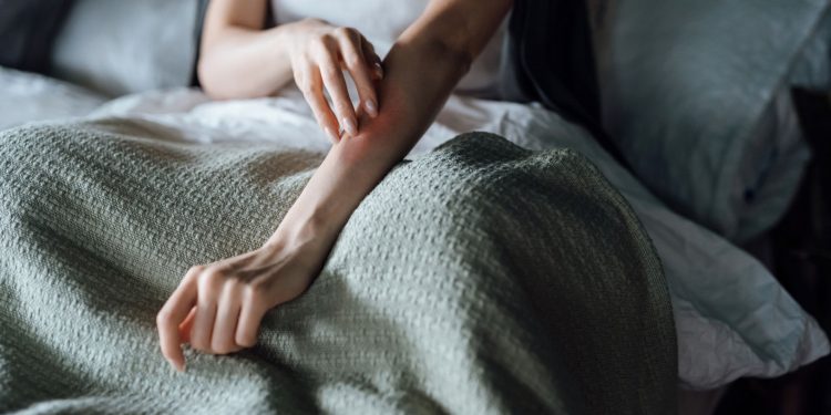 Νορβηγική Ψώρα