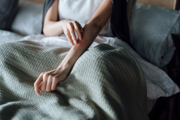 Νορβηγική Ψώρα