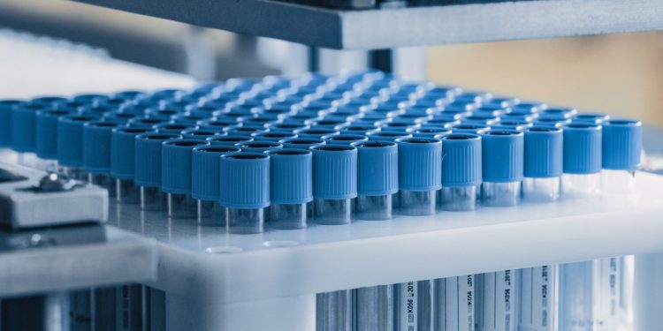 Ανησυχία για την πρόσβαση των Ελλήνων ασθενών σε νέες, καινοτόμες θεραπείες.