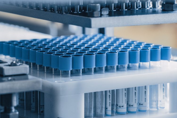 Ανησυχία για την πρόσβαση των Ελλήνων ασθενών σε νέες, καινοτόμες θεραπείες.