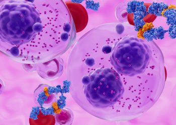 Νέα δεδομένα για το ασυμπτωματικό πολλαπλό μυέλωμα