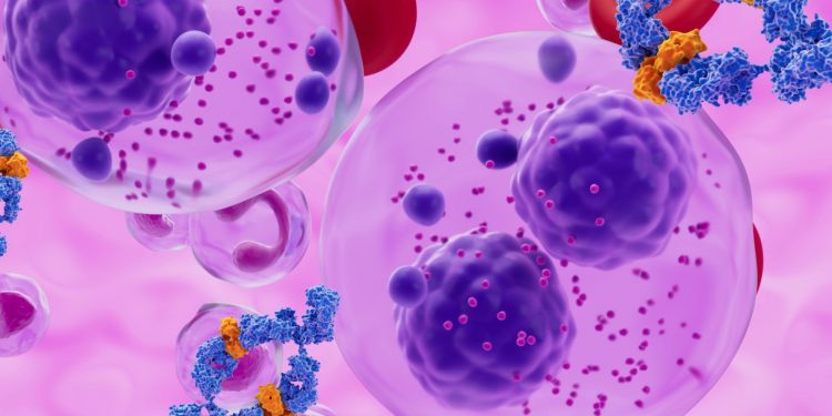 Νέα δεδομένα για το ασυμπτωματικό πολλαπλό μυέλωμα