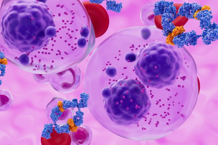 Νέα δεδομένα για το ασυμπτωματικό πολλαπλό μυέλωμα