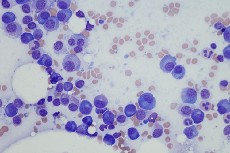 Πολλαπλούν μυέλωμα