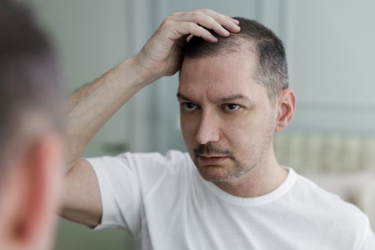 φάρμακα για τριχόπτωση