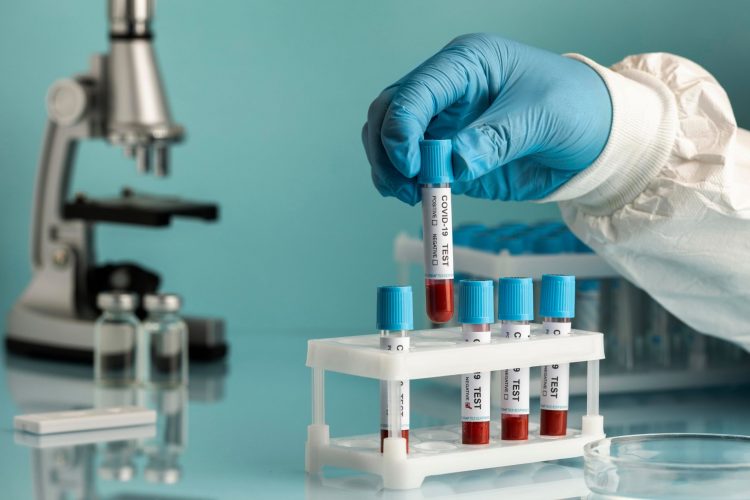 Εξέταση αίματος αρκετά ακριβής βρίσκει την νόσο Αλτσχάιμερ σε πρώιμο στάδιο