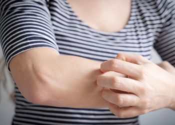 Γιατί τα κουνούπια δεν τσιμπάνε όλους μας το ίδιο;