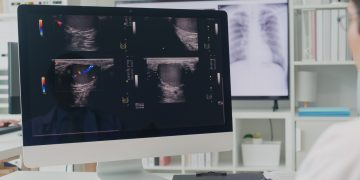 Κλινική μελέτη-ορόσημο για τον καρκίνο του μαστού