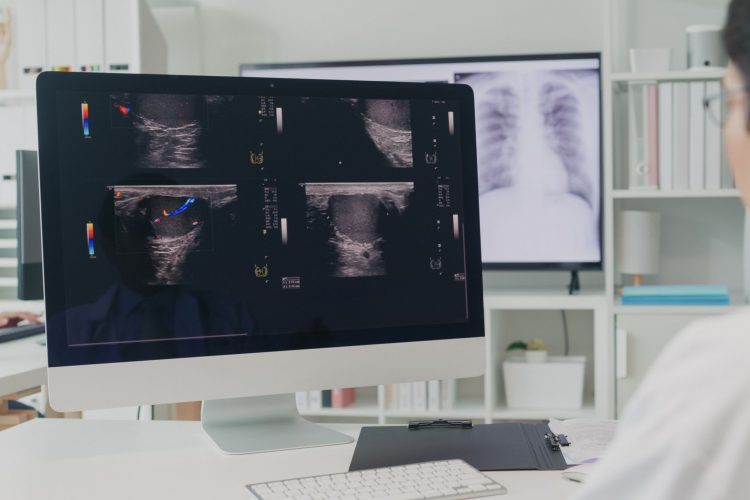 Κλινική μελέτη-ορόσημο για τον καρκίνο του μαστού