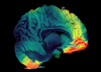 Πρώτη παγκόσμια δοκιμή για πρωτοποριακή μαγνητική τομογραφία