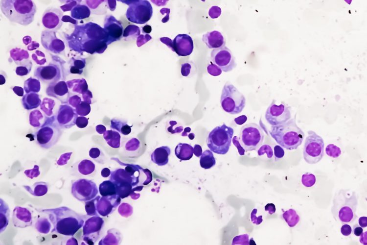 Ξεκινάει στην Αγγλία η θεραπεία: «Δούρειος Ίππος» για το Πολλαπλό Μυέλωμα