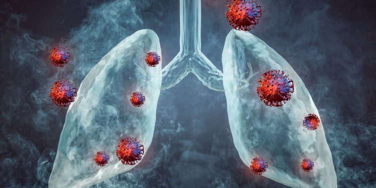 Νέα ανοσοθεραπεία επιμηκύνει τη ζωή ασθενών με μικροκυτταρικό καρκίνο του πνεύμονα