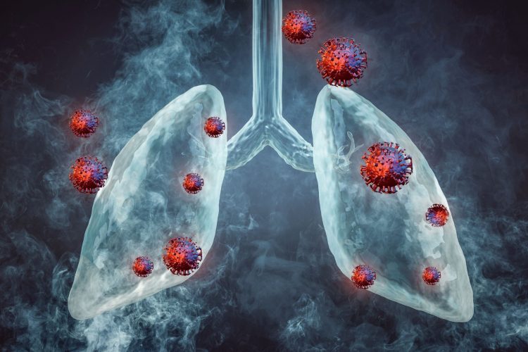 Νέα ανοσοθεραπεία επιμηκύνει τη ζωή ασθενών με μικροκυτταρικό καρκίνο του πνεύμονα