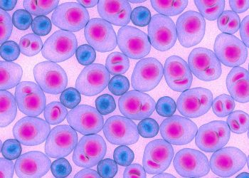 Ελληνική Πρωτοπορία στην διαχείριση και θεραπεία του πολλαπλού μυελώματος