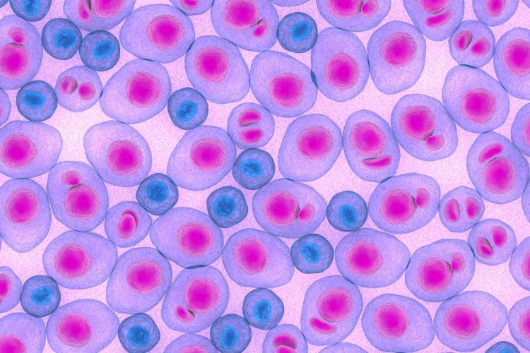 Ελληνική Πρωτοπορία στην διαχείριση και θεραπεία του πολλαπλού μυελώματος