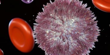 Michel Hoffman: Ο αιματολόγος που άλλαξε την κατανόηση της μυελοΐνωσης