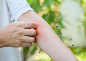 Οδηγός προστασίας από τα τσιμπήματα: Ποια εντομοκτόνα είναι αποτελεσματικά;