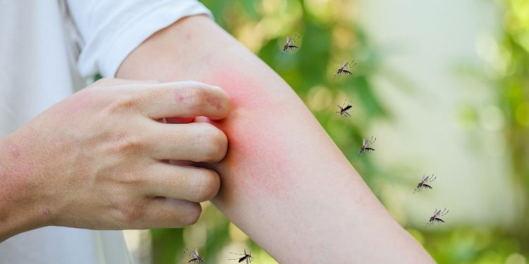 Οδηγός προστασίας από τα τσιμπήματα: Ποια εντομοκτόνα είναι αποτελεσματικά;