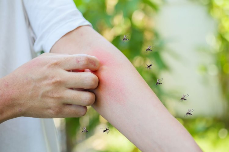Οδηγός προστασίας από τα τσιμπήματα: Ποια εντομοκτόνα είναι αποτελεσματικά;