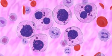 Η Ευρωπαϊκή Επιτροπή εγκρίνει για πρώτη φορά θεραπεία για ασθενείς με ασυμπτωματικό πολλαπλούν μυέλωμα υψηλού κινδύνου για εξέλιξη σε συμπτωματική νόσο