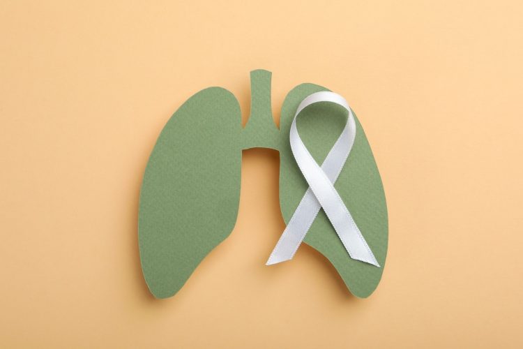 Προσυμπτωματική διάγνωση του καρκίνου του πνεύμονα