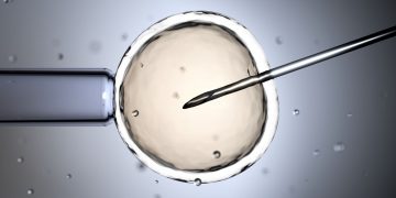 Η Παχυσαρκία μειώνει τις πιθανότητες εγκυμοσύνης με τεχνητή γονιμοποίηση