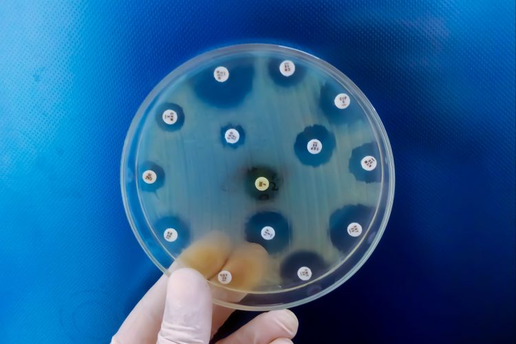 Τα αρχαιότερα μικρόβια ίσως κρατούν το κλειδί κατά της αντοχής στα αντιβιοτικά