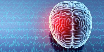 Ώρα για ουσιαστικές παρεμβάσεις για τη στοχευμένη θεραπεία και την υποστήριξη των ασθενών με ημικρανία