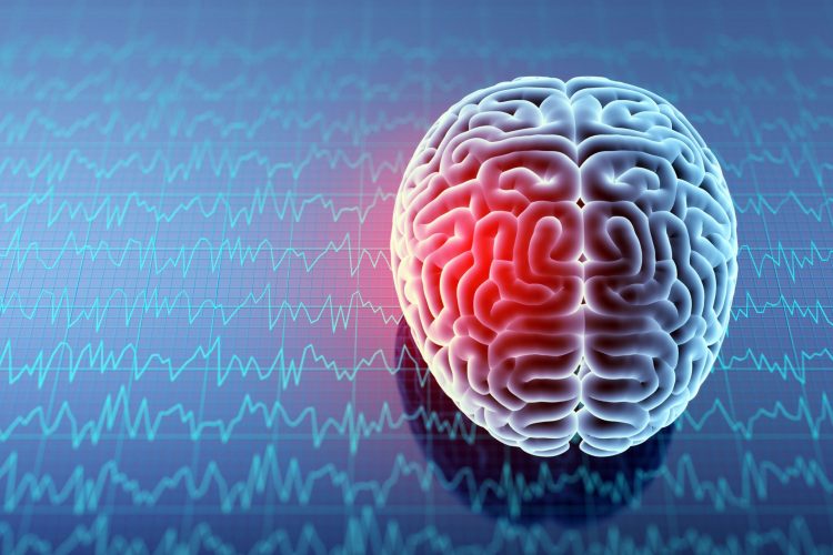 Ώρα για ουσιαστικές παρεμβάσεις για τη στοχευμένη θεραπεία και την υποστήριξη των ασθενών με ημικρανία