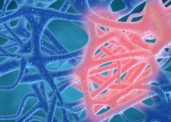 Χρόνια Φλεγμονή: Η σιωπηλή επιδημία του 21ου αιώνα που ευθύνεται για το 20% των θανάτων παγκοσμίως