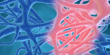 Χρόνια Φλεγμονή: Η σιωπηλή επιδημία του 21ου αιώνα που ευθύνεται για το 20% των θανάτων παγκοσμίως