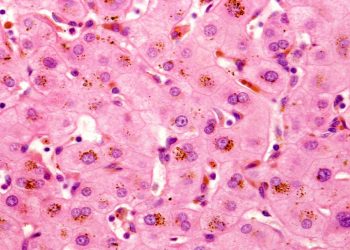 Καμπάνια ενημέρωσης για την Οικογενή Ενδοηπατική Χολόσταση