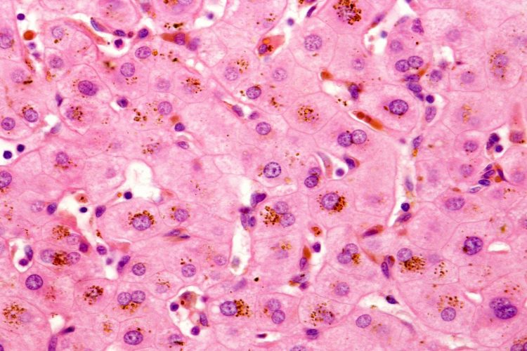 Καμπάνια ενημέρωσης για την Οικογενή Ενδοηπατική Χολόσταση