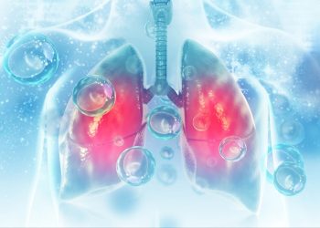 Νεότερες εξελίξεις στην αντιμετώπιση του μικροκυτταρικού καρκίνου του πνεύμονα