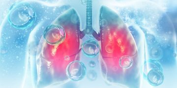 Νεότερες εξελίξεις στην αντιμετώπιση του μικροκυτταρικού καρκίνου του πνεύμονα