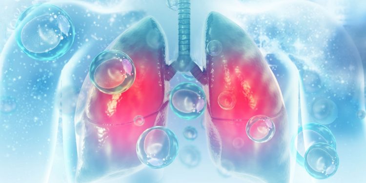 Νεότερες εξελίξεις στην αντιμετώπιση του μικροκυτταρικού καρκίνου του πνεύμονα